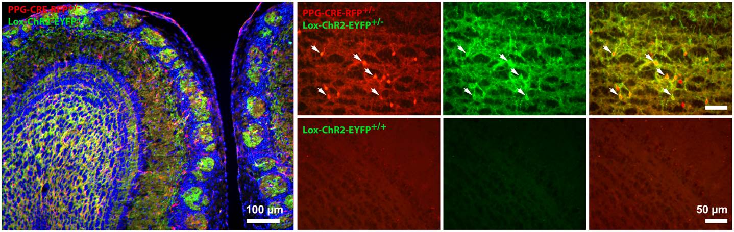 Brain-Slice preparation